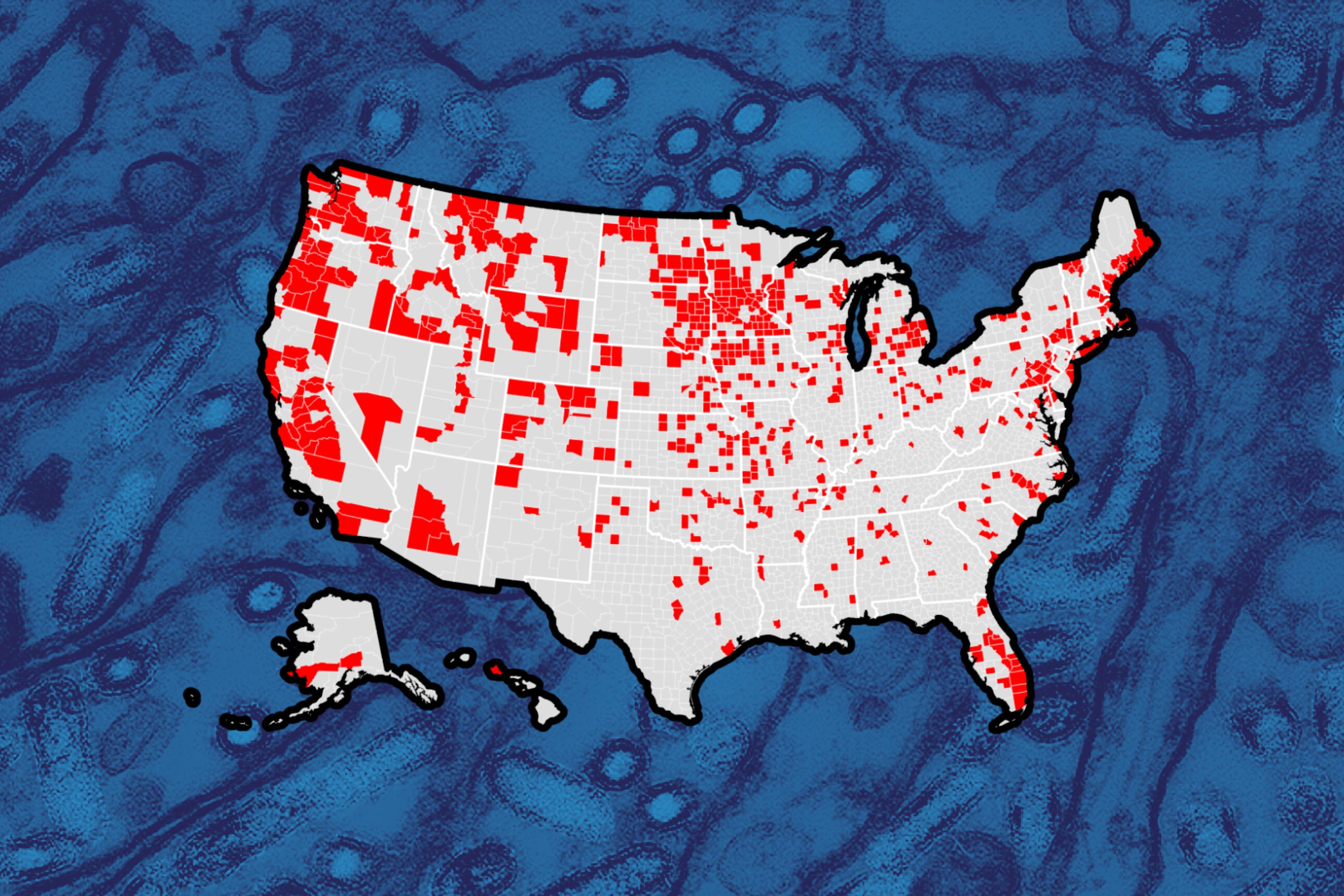 US map showing bird flu outbreak areas (CDC/NIAID via AP)